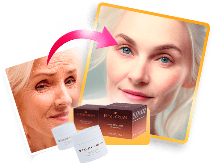 Elesse Cream